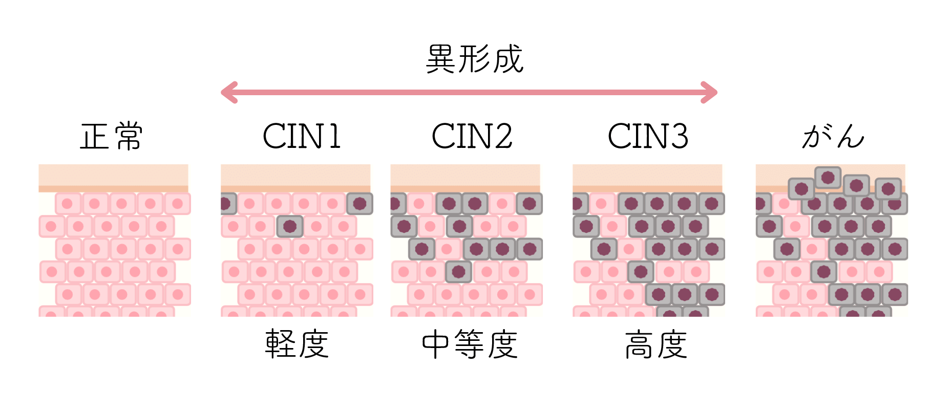 異形成